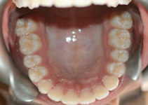 orthodontic treatment after