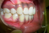 orthodontic treatment after