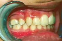 orthodontic treatment after